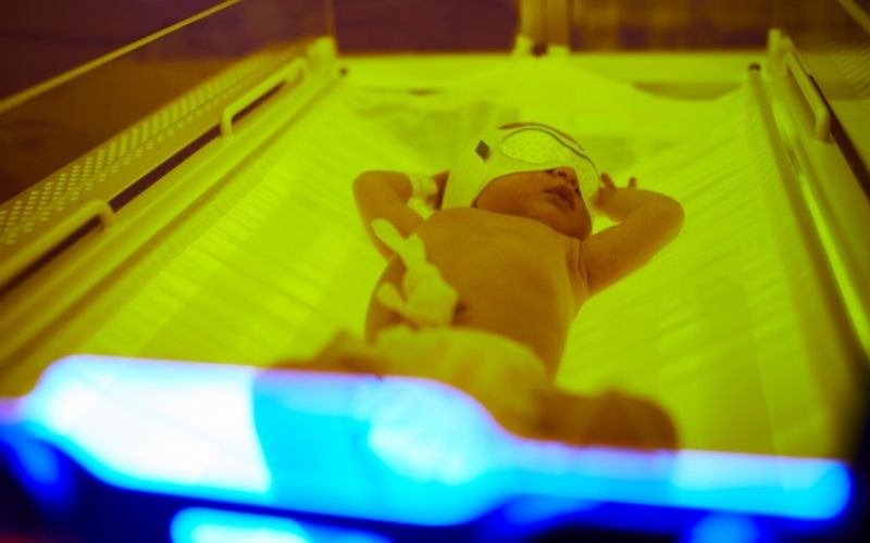 Phương pháp quang trị liệu vàng da ở trẻ sơ sinh